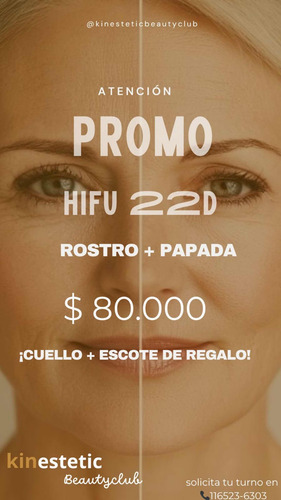 Hifu 22 D Lifting No Quirúrgico