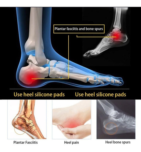 Imagem 2 de 4 de Palmilhas Plantar Confortável Ajuste Sapato Pronta Entrega