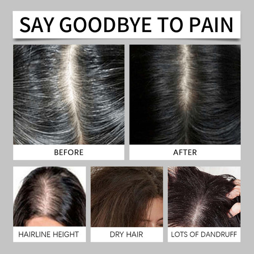 Alopecias De Arroz: Raízes Fortes E Resistentes, Reduzem O D