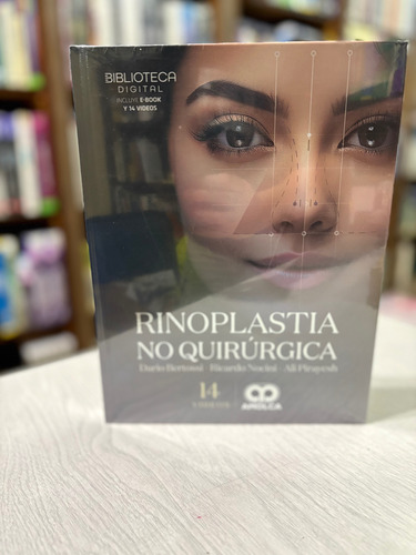 Bertossi.rinoplastia No Quirúrgica