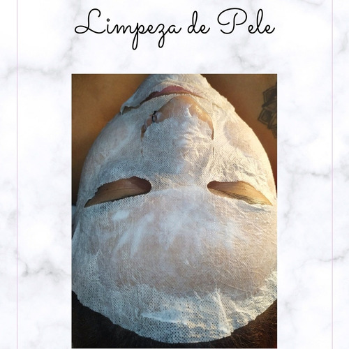 Imagem 3 de 4 de Limpeza De Pele