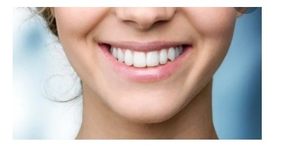 Imagen 1 de 1 de Limpieza Dental
