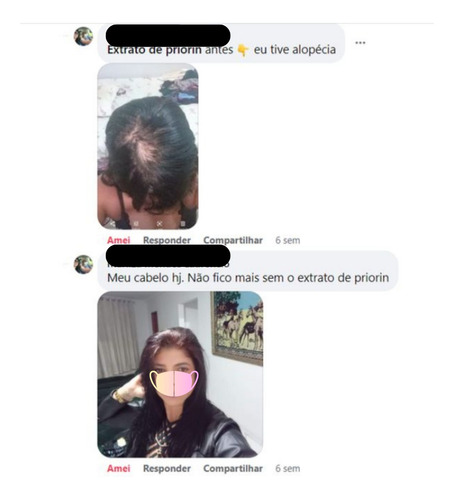 Extrato De Priorin Vitamina Cresce Cabelo Anti Queda Capilar