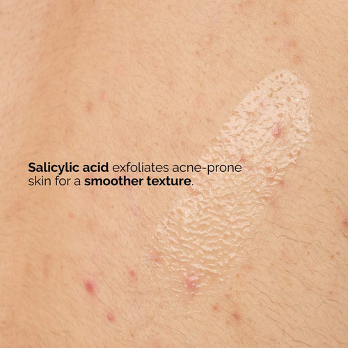 The Ordinary Salicylic Acid 0.5% Body Serum Original Acne