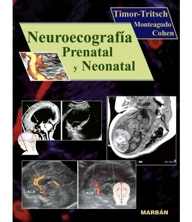 Neuroecografía Prenatal Y Neonatal