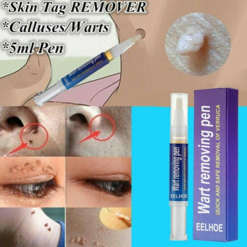 Ee Pluma Liquido Removedor De Mezquinos Y Verrugas