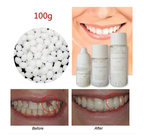 Imagen 3 de 8 de Kit De Reparación De Huecos De Dientes Postizos Temporales A