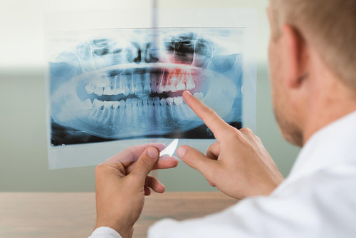 Imagen 6 de 6 de Radiografía Panorámica Dental