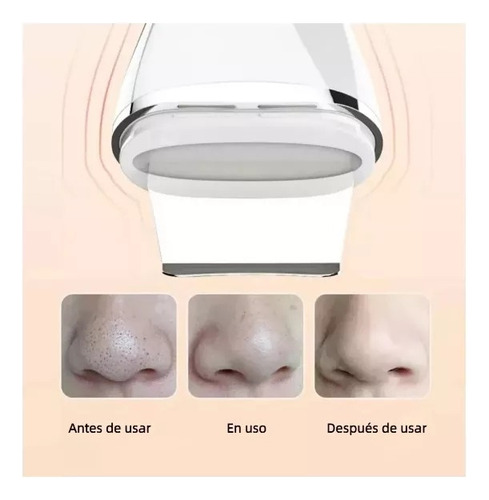 Limpiador Facial Ultrasónico 2 En 1 Con Exfoliador Blanco