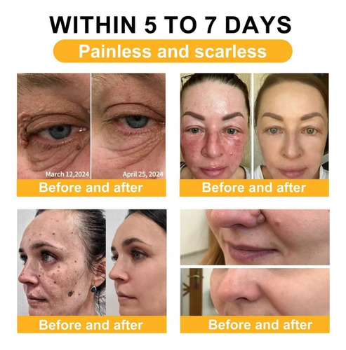 Crema Reparadora Quick Skin De 7 Días, Crema Todo En Uno *2