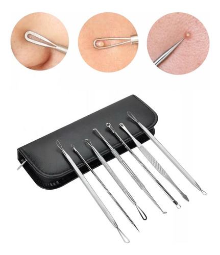 Kit Extrator De Cravos E Espinhas 7 Curetas Aço Inoxidável