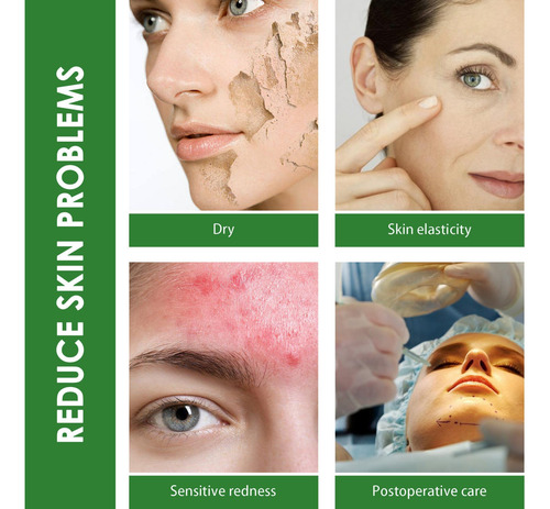 Mascarilla Facial De Espuma H Centella Asiatica Foam Faci 70