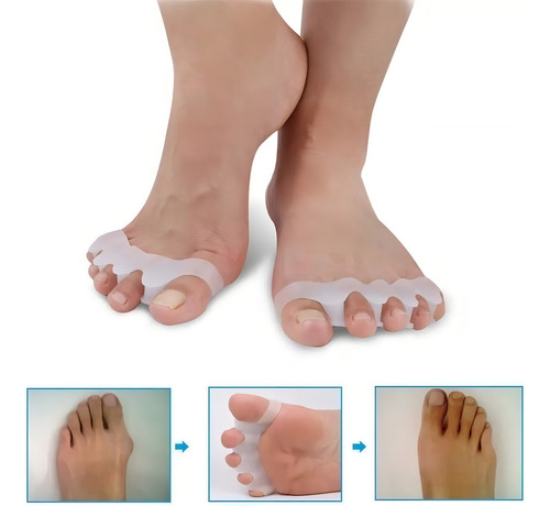 Par Separador De Dedos Para Os Pés Cor Branco