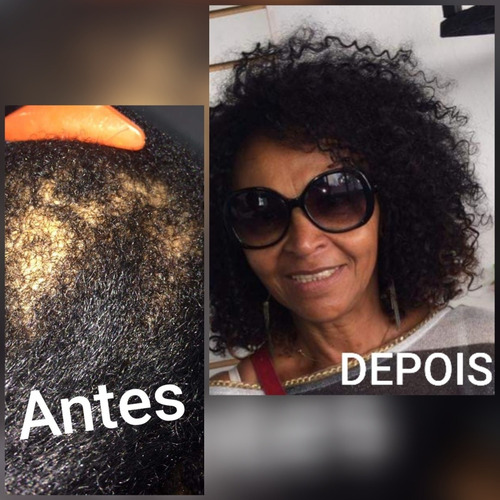 Imagem 2 de 5 de Alongamento De Cabelos