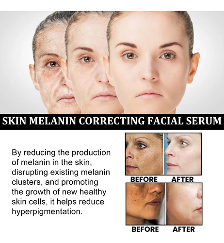 L Melanin Facial Repair Hidrata La Piel, Blanquea Y Decolora