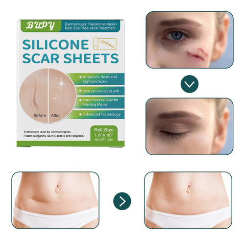 Parche De Gel De Silicona L Para Cicatrices, Impermeabilizan