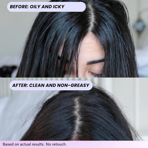 Shampoo A Seco Foxybae Foxybae Com Biotina Para Volume