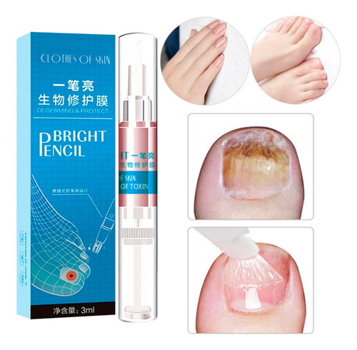 Reparador Uñas Anti Hongos Micosis Pie Atleta Infecciones