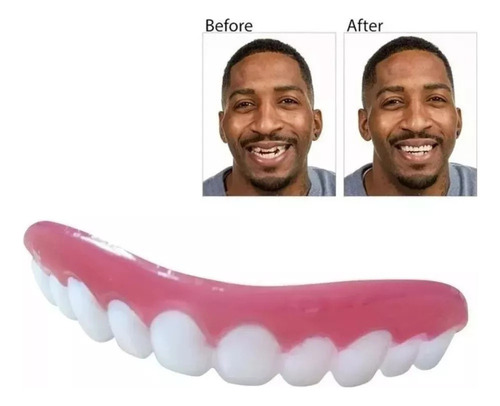 Nuevo 2 Juegos De Dentaduras Postizas De Silicona Simuladas