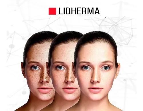 Lidherma Formula Despigmentante C/tranexámico X50g