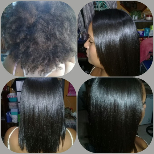 Cirugia Capilar Celulas Madres Litro K - L a $44000