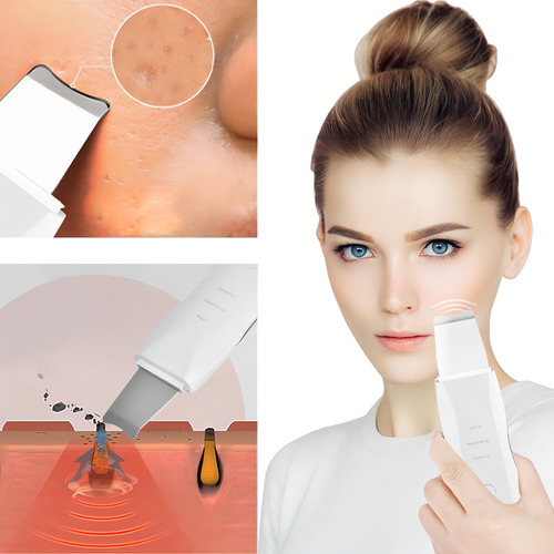 Espátula Facial Ultrasónica Usb Sonic Skin Scrubber