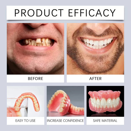 Fit Juego De Prótesis Dentales Superiores E Inferiores