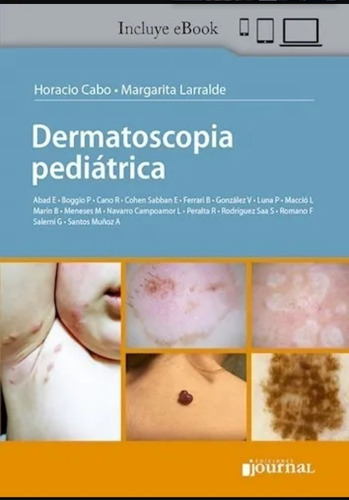 Dermatoscopia Pediatrica