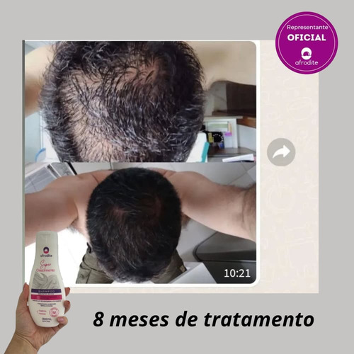 Kit 2 Shampoo Super Crescimento Anti-queda Afrodite