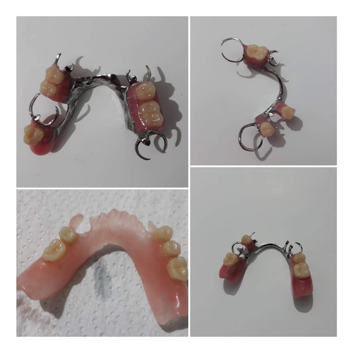 Protesis Dentales Y Flexibles A Domicilio