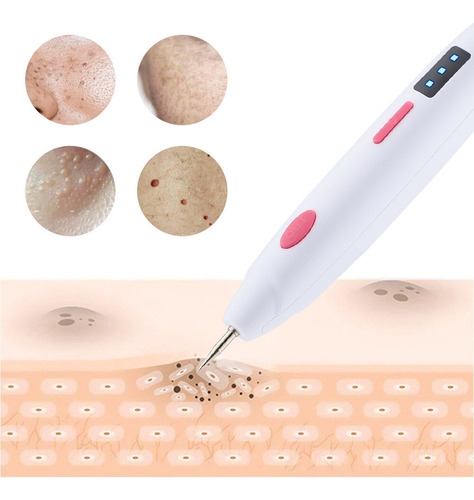 R Nevus Pen Repair Spot T Extracción De Nevus Scanning Y Spo