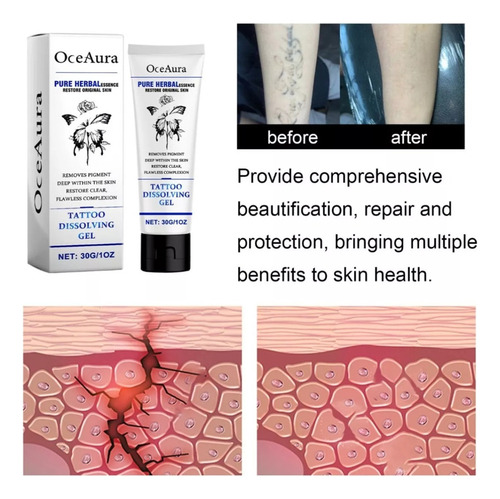 Crema Para Eliminar Tatuajes En Crema, 2 Unidades