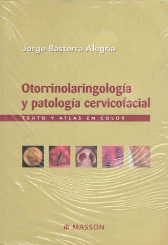 Otorrinolaringologia Y Patologia Cervicofacial Texto Y Atlas