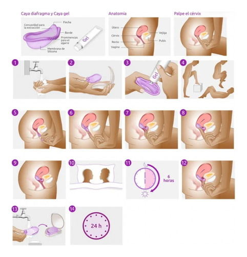 Anticonceptivo Diafragma + Gel Caya
