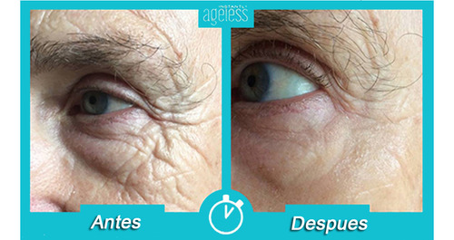 Instantly Ageless 20 Ampolletas + Muestra Crema Antiedad Todo Tipo De Piel Día/noche