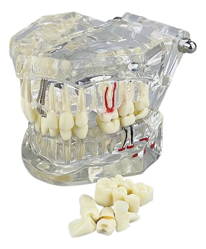 Modelo Dental Didáctico De Estudio Y Demostracion