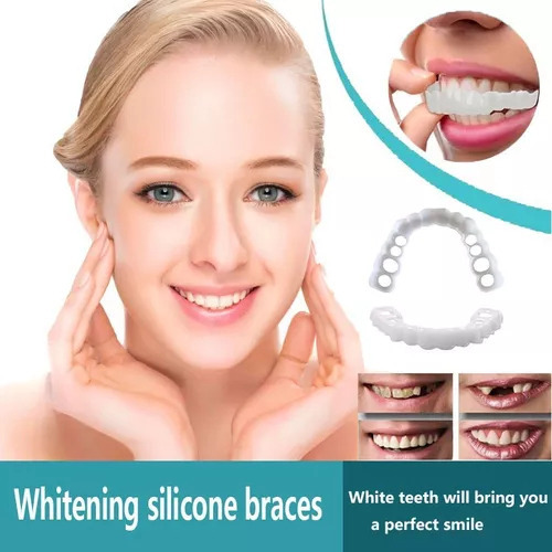 Facetas De Dentes Postiços De Sorriso Superior/inferior