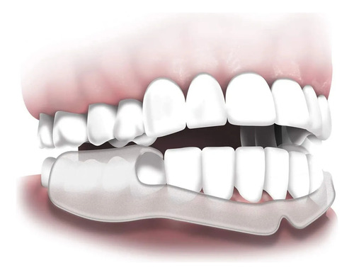 Plackers Grind No More Protector Dental Noche Rechinar 16 Pz