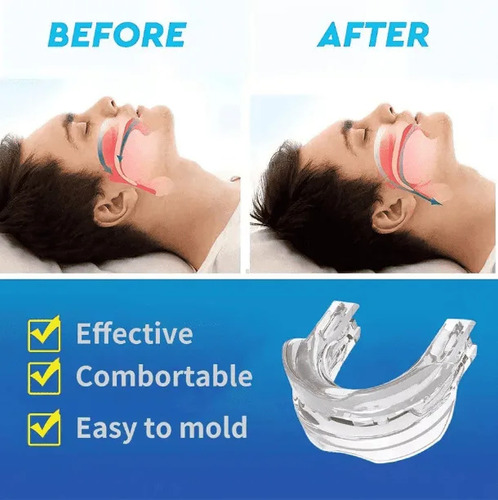 Boca Para Dormir, Anti-bruxismo, Dentes, Bruxismo, Proteção