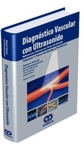 Diagnóstico Vascular Con Ultrasonido