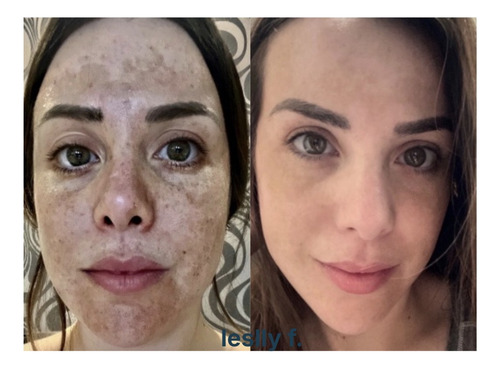 Set Limpia Corrige Y Protege Neora Vegano Sustancias Limpias
