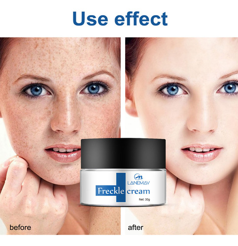 Crema Eliminadora De Pecas A And Small And Hidratante Fac 80