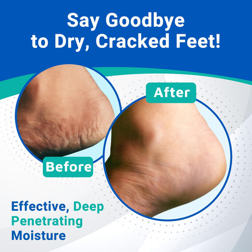 Creme Para O Cuidado Do Calcanhar Dermal Therapy Hidratante