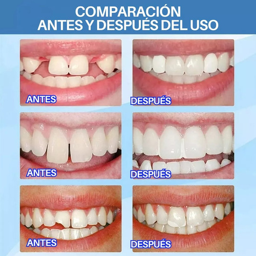 Perlas Reparación Dientes Postizos Dientes Gránulos 30ml