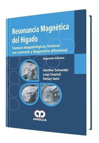 Resonancia Magnética Del Hígado. Técnicas Imagenológicos.