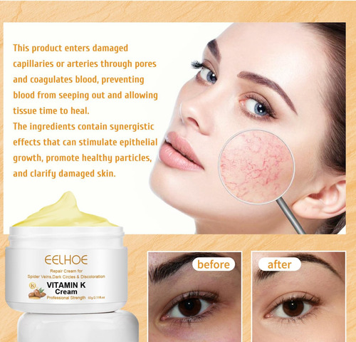 2pcs Venas Varicosas Crema Milagrosa Con Vitamina K Adecuado