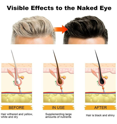 Yan 4 Barras De ChampĂș For Oscurecer Las Canas Y El Cabello