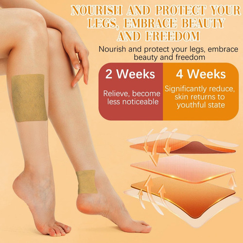 Tratamiento De Cúrcuma Para Aliviar Las Varices En Las Piern