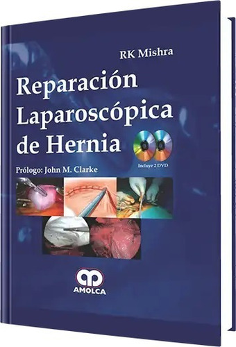 Reparacion Laparoscópica De Hernia Incluye 2 Dvd