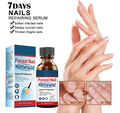 Set Reparador De Uñas Extra Fuerte K Nail Toenail Fingernail